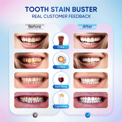 🦷Achieve a Radiant Smile -Niacinamide Whitening Toothpaste